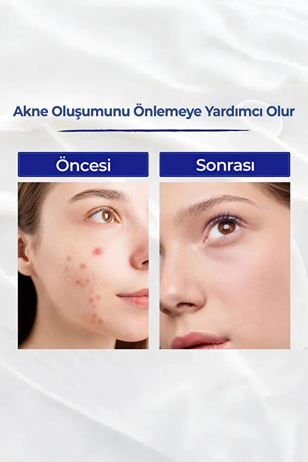 A313 Retinol Krem 50g | Vitamin A Yaşlanma & Kırışıklık Karşıtı Bakım